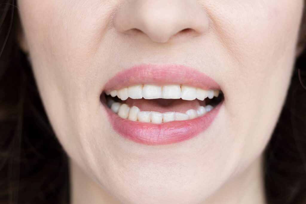 beeld bij blog over tandenknarsen